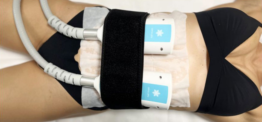 Trattamento B-Shock crioterapia ed elettrostimolazione